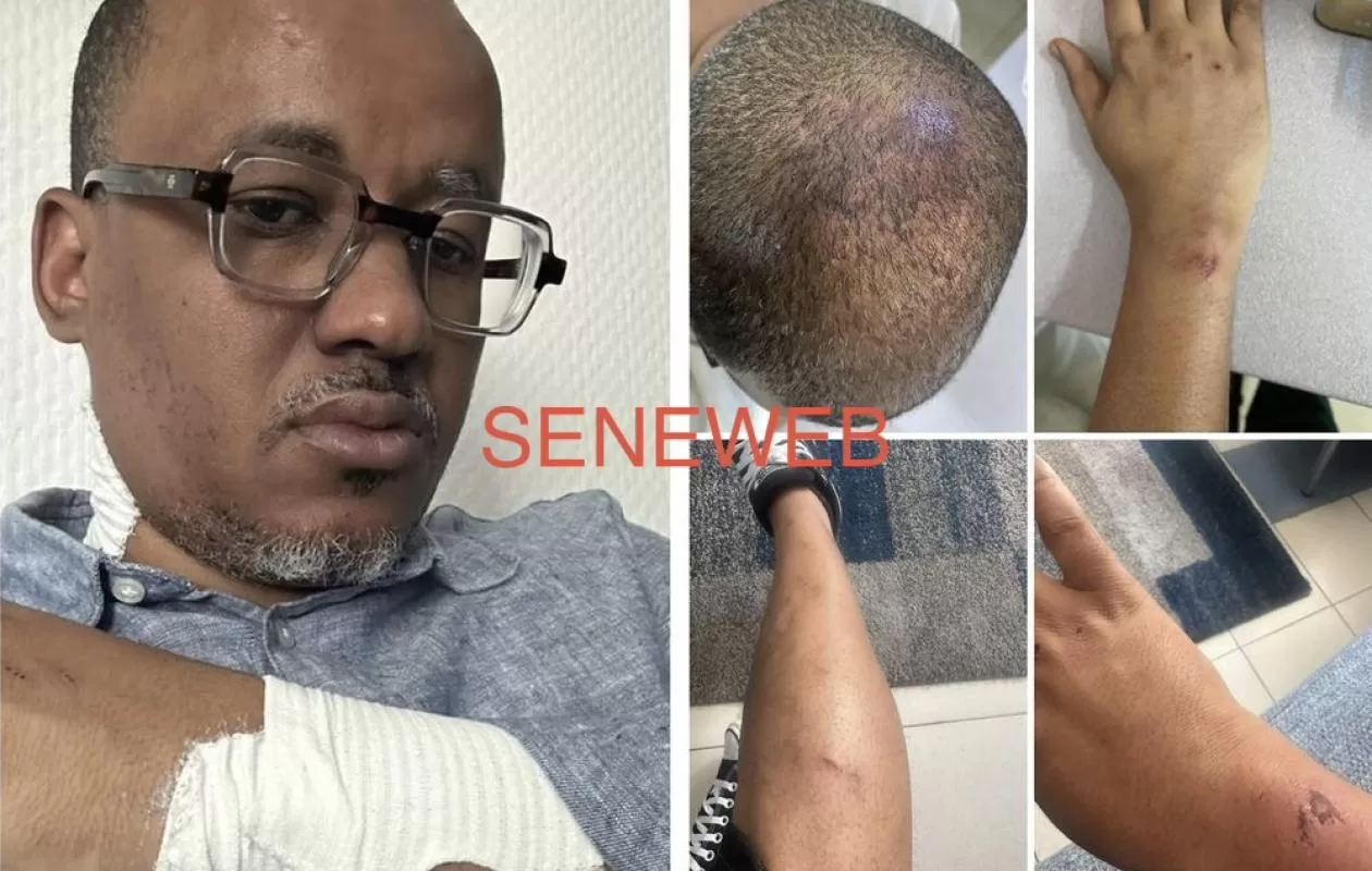 Tribunal de Pikine-Guédiawaye : Oumar Sow saisit le juge d’instruction pour des violences qu’il qualifie de torture